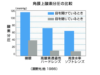 起床直後の角膜厚みの増加率